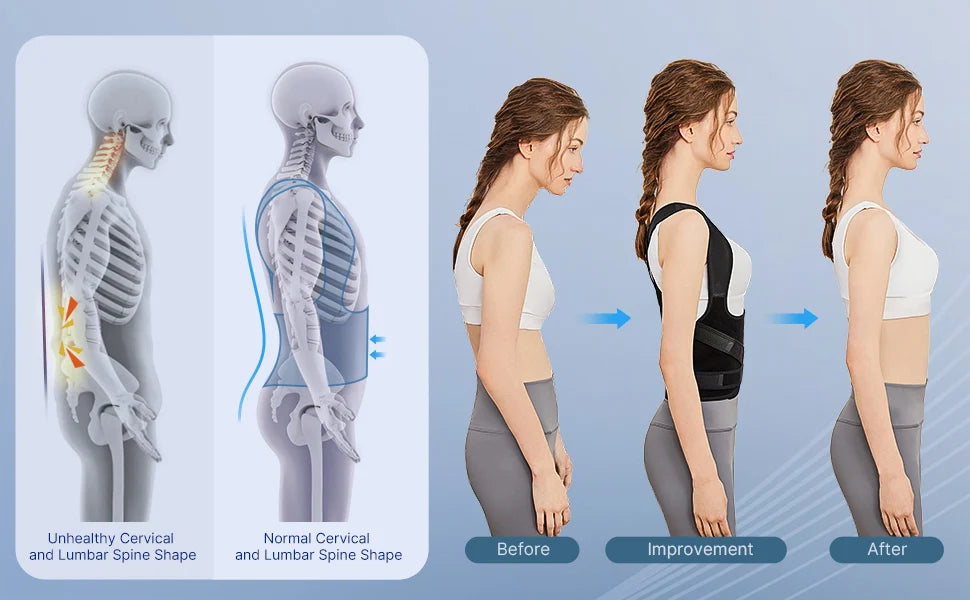 PelvicEase™ Smart Posture Corrector Brace